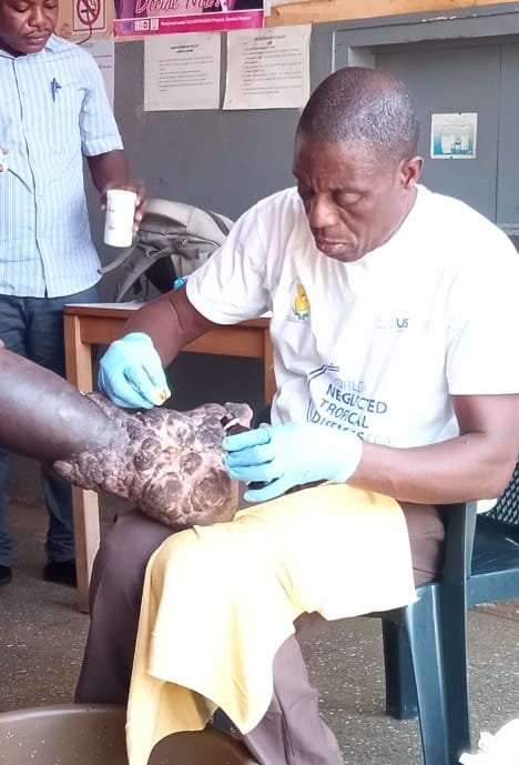 Neglected Tropical Disease